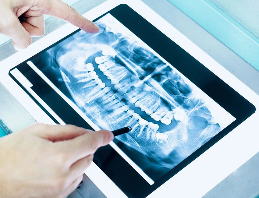 Digital X-rays