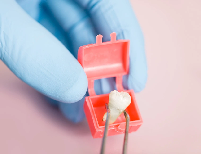 Wisdom Teeth Removal at West Hollywood Dental Studio
