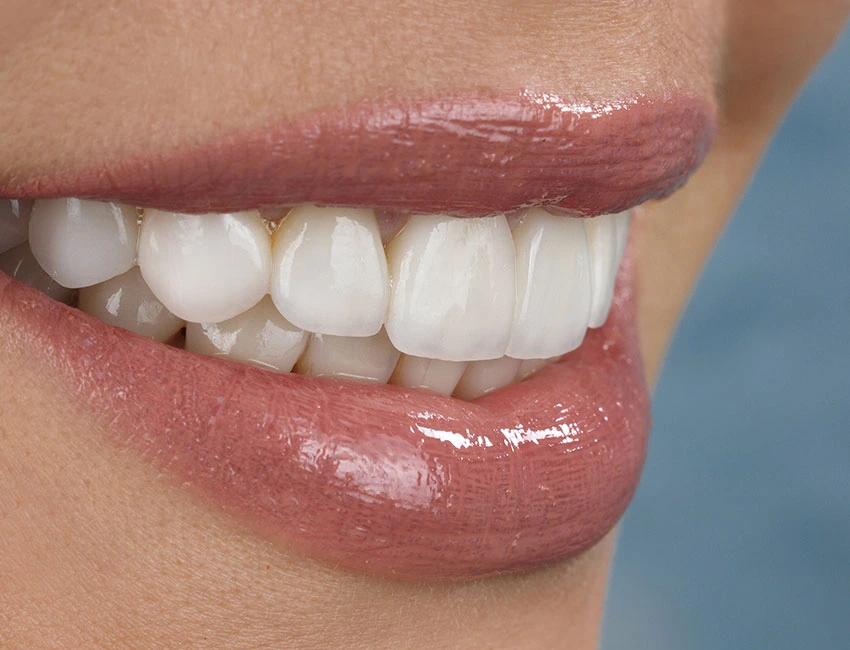 Cosmetic Dentistry in West Hollywood, CA