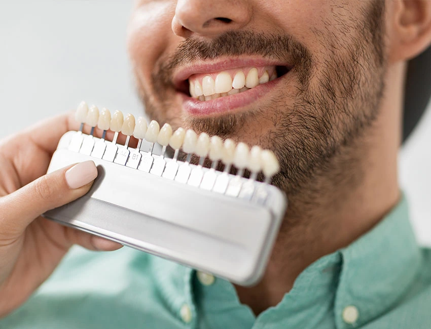 Teeth Whitening at West Hollywood Dental Studio