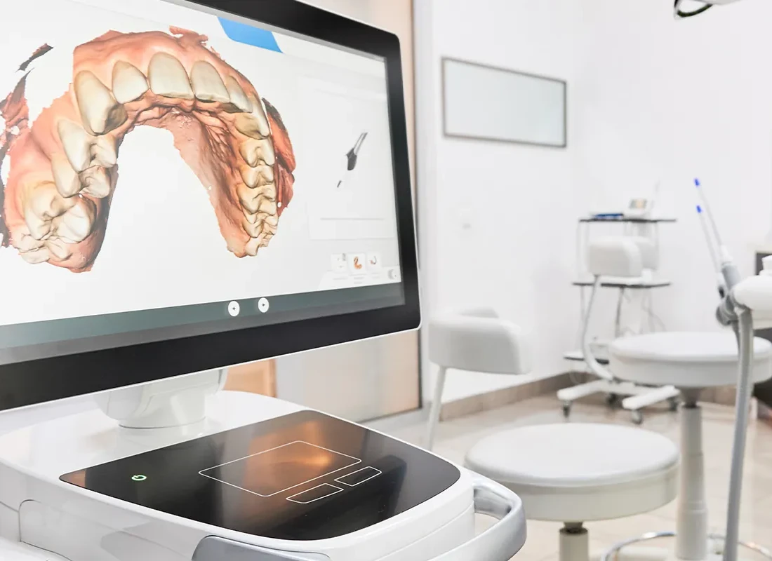 iTero Scanner