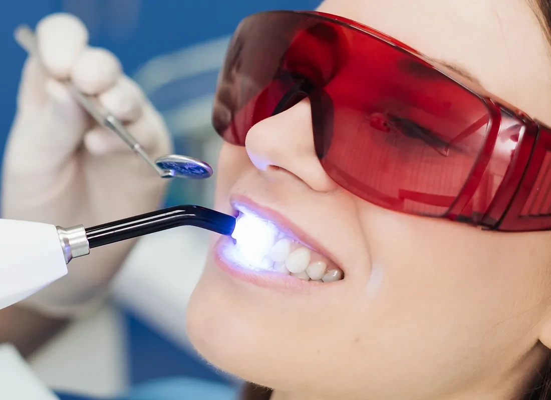 Laser Dentistry