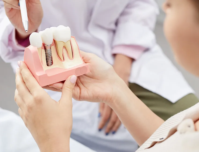Single-Tooth Implant in West Hollywood, CA