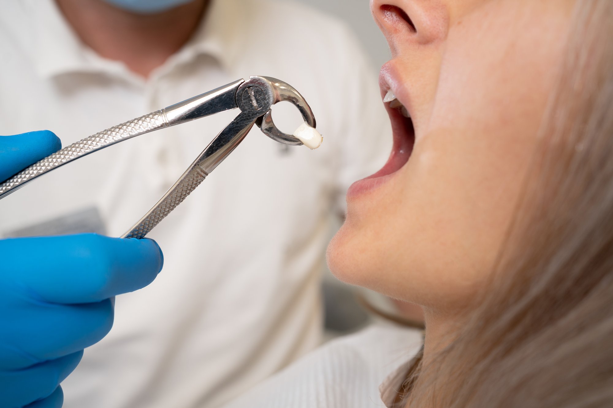 patient after tooth extraction